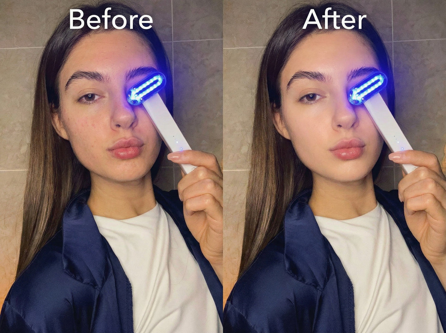 ZAQ Zayn 2.0 Advanced LED & Microcurrrent Facial Recovery System